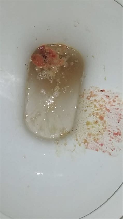 pink na puke|SIRO.